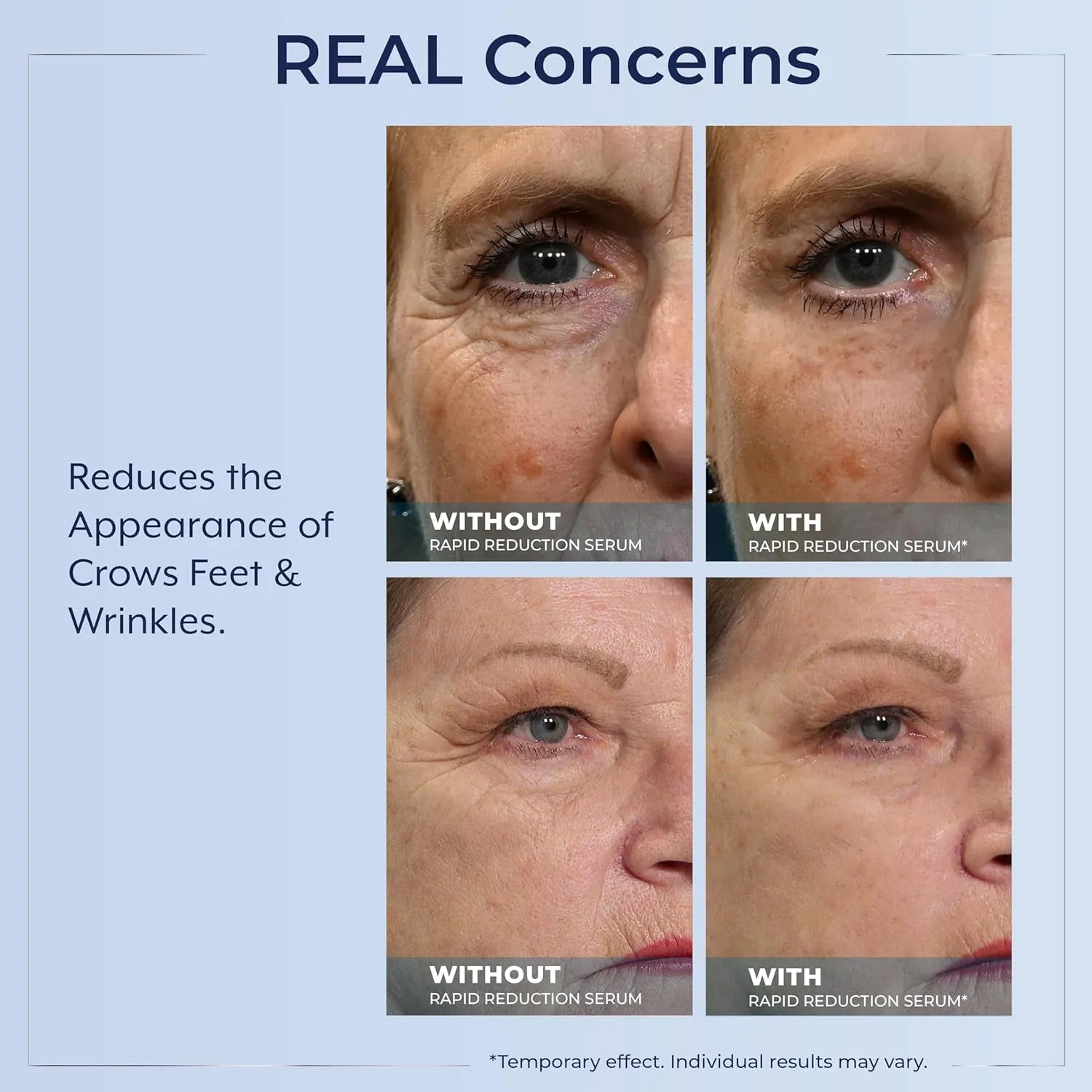 Rapid Reduction Eye Serum - Visibly Reduces Under-Eye Bags, Wrinkles, Dark Circles, Fine Lines & Crow'S Feet Instantly, anti Aging Wrinkle Remover for Face, 30 Single Use Pods