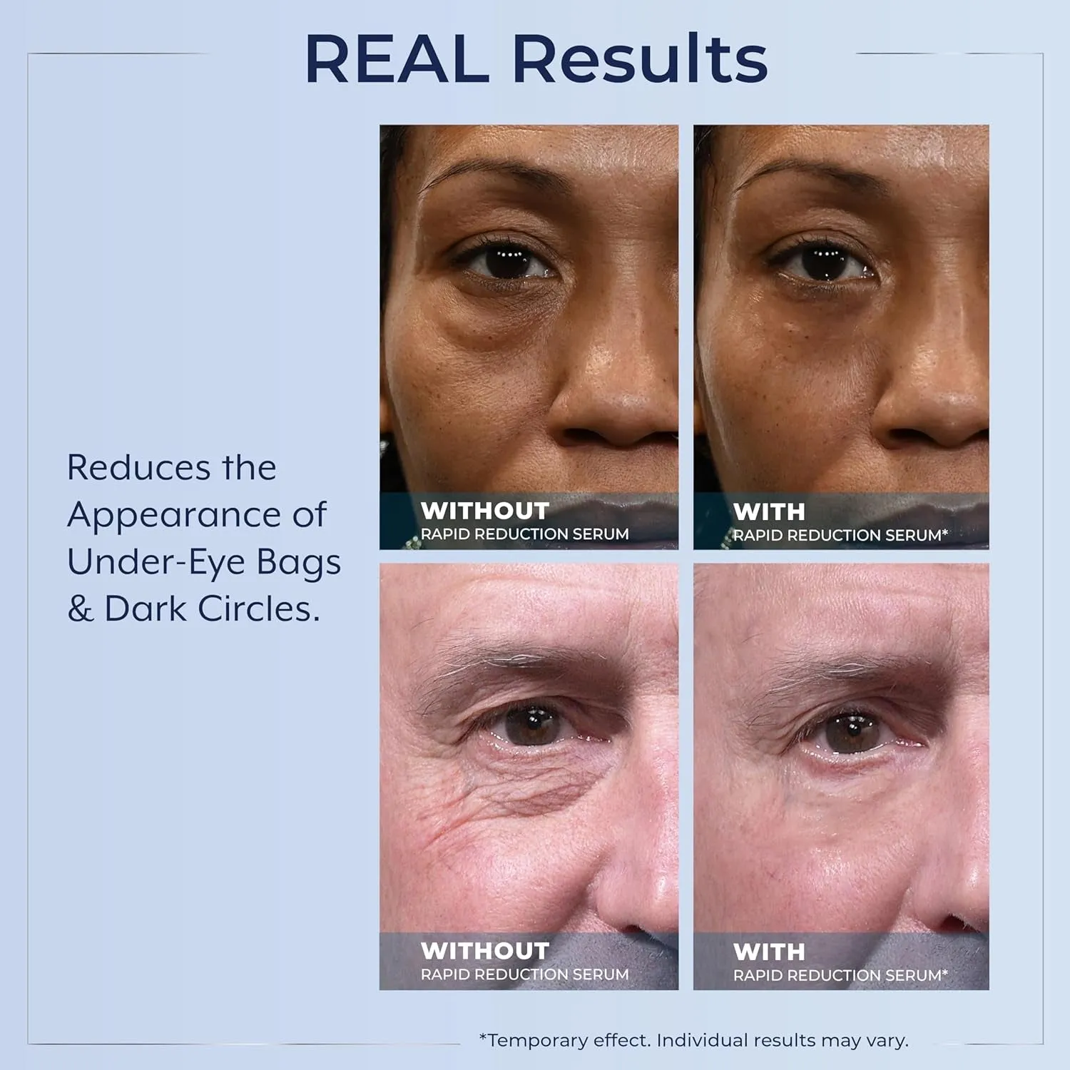 Rapid Reduction Eye Serum - Visibly Reduces Under-Eye Bags, Wrinkles, Dark Circles, Fine Lines & Crow'S Feet Instantly, anti Aging Wrinkle Remover for Face, 30 Single Use Pods